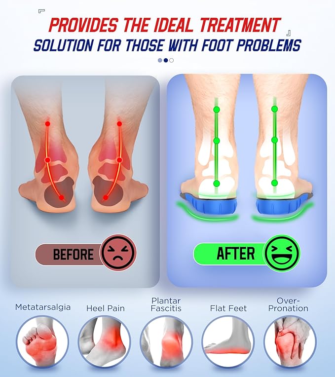 240+lbs Heavy Duty High Arch Support Orthotic Insoles for Plantar Fasciitis Pain Relief